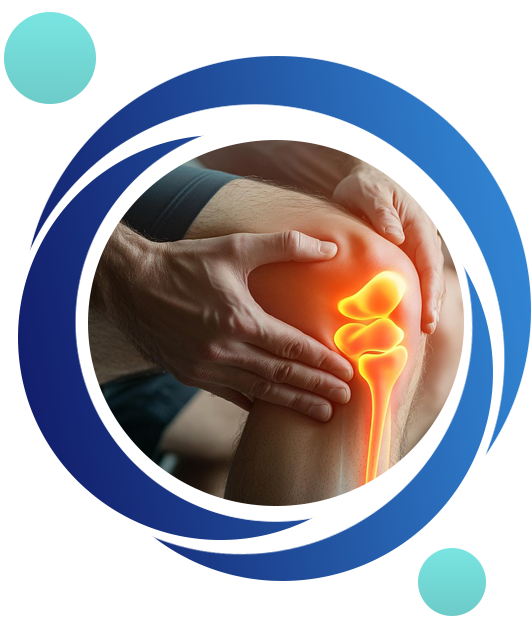 Knee Osteoarthritis Clinical Trial